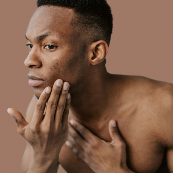 HYDROCHINON DIE WAHRHEIT ÜBER DEN UMSTRITTENEN INHALTSSTOFF IN DER HA